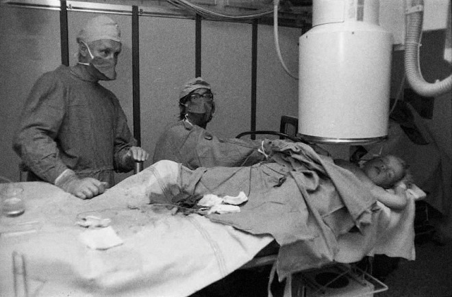 4. Srdeční katetrizace dítěte, Pediatrické kardiocentrum FNM – Dr. St. Tůma. 80. léta.